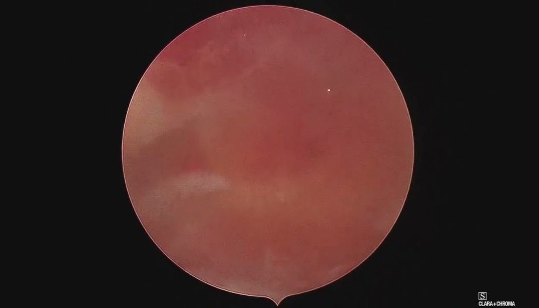 septum minor